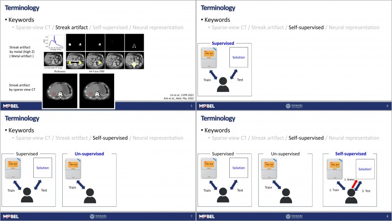 [Journal Club] A streak artifact reduction algorithm in sparse-view CT ...