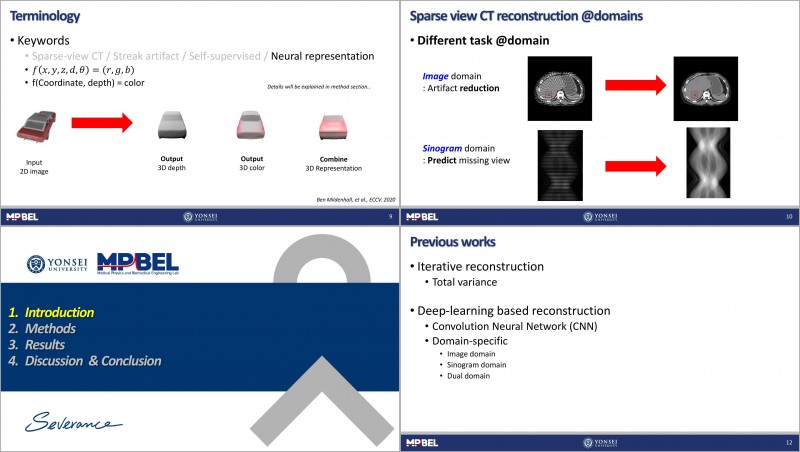 [Journal Club] A streak artifact reduction algorithm in sparse-view CT ...