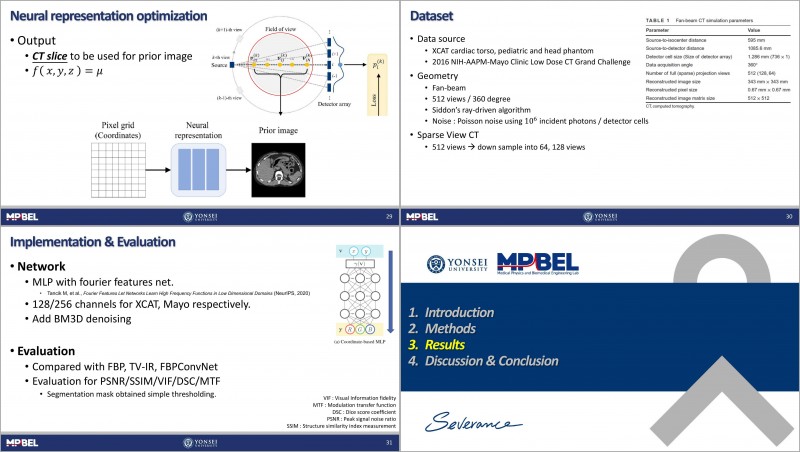 [Journal Club] A streak artifact reduction algorithm in sparse-view CT ...