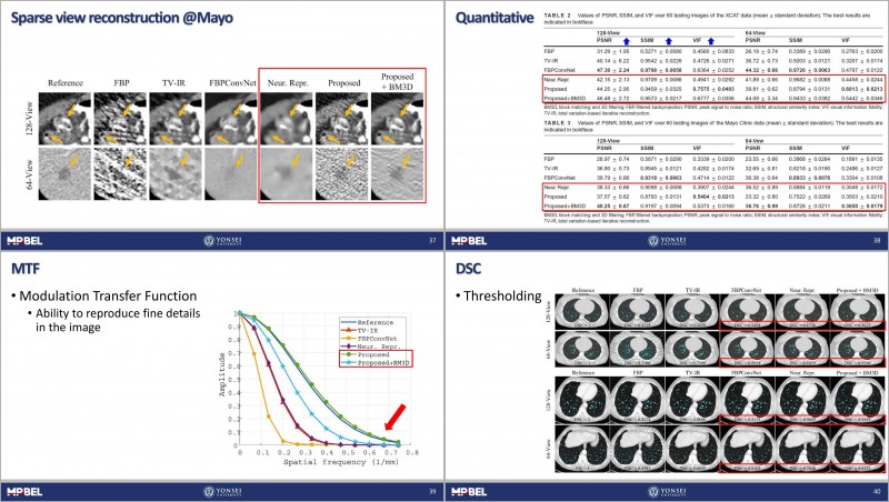 [Journal Club] A streak artifact reduction algorithm in sparse-view CT ...