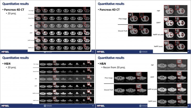 [Journal Club] Implicit Neural Representation Learning With Prior ...